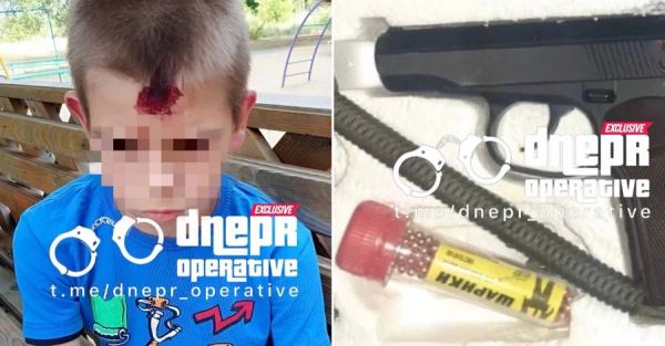 У Кривому Розі військовий стріляв по дитячому майданчику: поранений 10-річний хлопчик  - Новини України