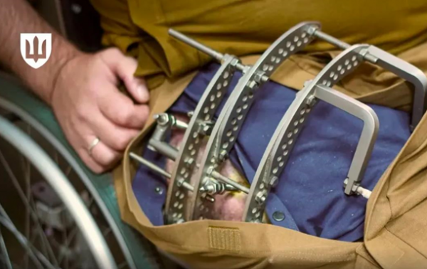 Військові почали отримувати Пакунок пораненого Військові почали отримувати Пакунок пораненого